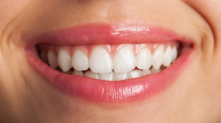 Ref: TRKR20170123001 - Búsqueda de fabricantes de materiales dentales (implantes) y huesos artificiales